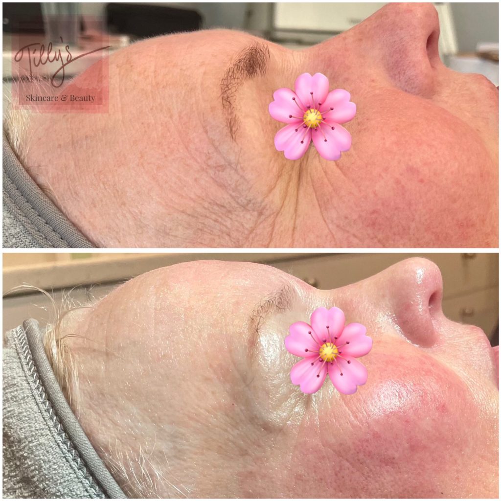 6441c38e 1309 46d5 9224 0ee58bfc854c