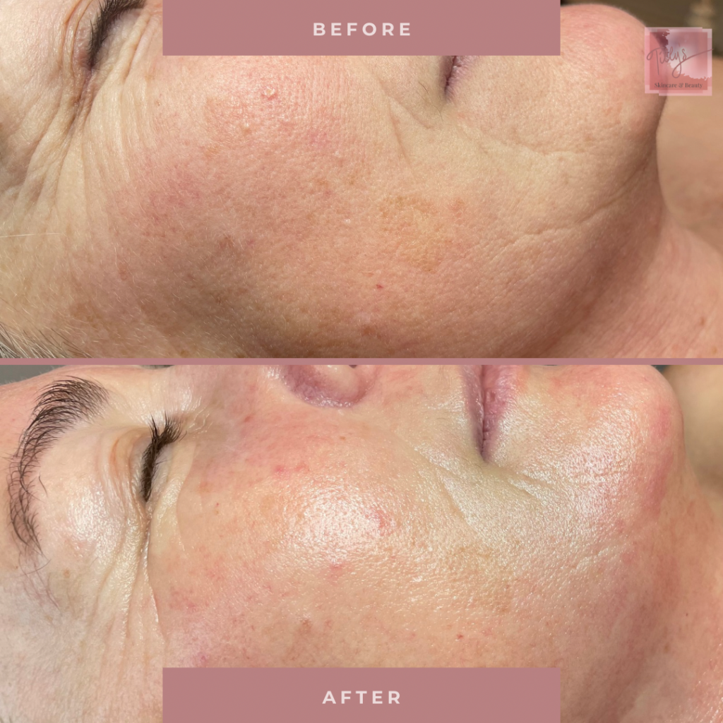 Copy Of Untitled Design 2